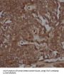 Signal Transducer And Activator of Transcription 1 (STAT1) Antibody