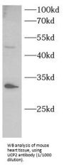 Mitochondrial Uncoupling Protein 2 (UCP2) Antibody