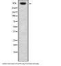 Ubiquitin Carboxyl-Terminal Hydrolase 34 (USP34) Antibody