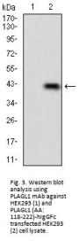 Zinc Finger Protein PLAGL1 (PLAGL1) Antibody