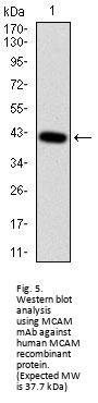 Melanoma Cell Adhesion Molecule (MCAM) Antibody