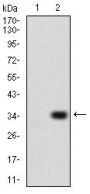 P2Y Purinoceptor 13 (P2RY13) Antibody