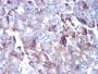 Cathepsin D (CTSD) Antibody