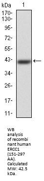 DNA Excision Repair Protein ERCC-1 (ERCC1) Antibody