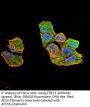DNA Excision Repair Protein ERCC-1 (ERCC1) Antibody
