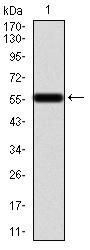 Calretinin (CALB2) Antibody