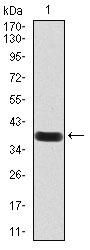 Paired Box Protein Pax-6 (PAX6) Antibody