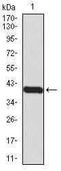PR Domain Zinc Finger Protein 1 (PRDM1) Antibody