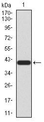 Neurotrophic Tyrosine Kinase Receptor Type 2 (NTRK2) Antibody