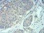 Methyl-CpG-Binding Protein 2 (MECP2) Antibody