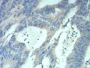 Methyl-CpG-Binding Protein 2 (MECP2) Antibody