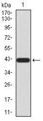 Methyl-CpG-Binding Protein 2 (MECP2) Antibody