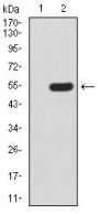 Methyl-CpG-Binding Protein 2 (MECP2) Antibody