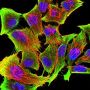 Tyrosine Hydroxylase (TH) Antibody