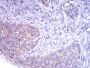 Tyrosine Hydroxylase (TH) Antibody
