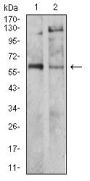Tyrosine Hydroxylase (TH) Antibody