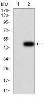 Tyrosine Hydroxylase (TH) Antibody
