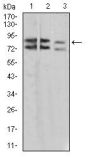 Interleukin-1 Receptor Accessory Protein-Like 1 (IL1RAPL1) Antibody
