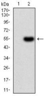 Alpha-1-Antitrypsin (SERPINA1) Antibody