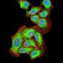 RAC-Alpha Serine/threonine-Protein Kinase (AKT1) Antibody