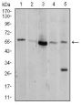 RAC-Alpha Serine/threonine-Protein Kinase (AKT1) Antibody