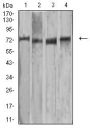 Matrix Metalloproteinase 2 (MMP2) Antibody