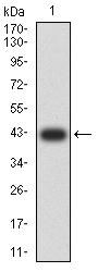 Matrix Metalloproteinase 2 (MMP2) Antibody