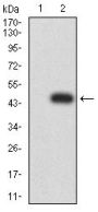 Matrix Metalloproteinase 2 (MMP2) Antibody