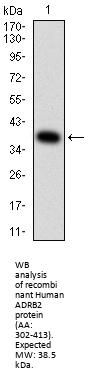Beta-2 Adrenergic Receptor (ADRB2) Antibody