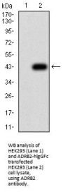 Beta-2 Adrenergic Receptor (ADRB2) Antibody