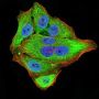 Neurofilament Medium Polypeptide (NEFM) Antibody