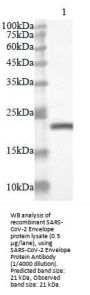 SARS-CoV-2 Envelope Protein Antibody
