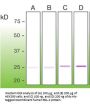 Apoptosis Regulator Bcl-2 (BCL2) Antibody