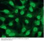 Apoptosis Regulator Bcl-2 (BCL2) Antibody