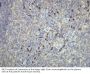 Immunoglobulin Kappa Light Chain (IGKC) Antibody