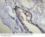 Keratin, Type I Cytoskeletal 14 (KRT14) Antibody