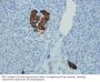 Synaptophysin (SYP) Antibody