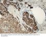 Synaptophysin (SYP) Antibody
