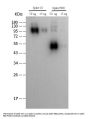 SARS-CoV-2 Spike Protein RBD Antibody