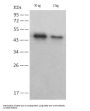 SARS-CoV-2 Nucleocapsid Protein Antibody