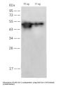 SARS-CoV-2 Nucleocapsid Protein Antibody