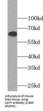 Apoptosis Antagonizing Transcription Factor (AATF) Antibody