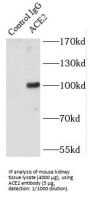 Angiotensin I Converting Enzyme 2 (ACE2) Antibody