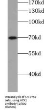 Activated CDC42 Kinase 1 (ACK1) Antibody
