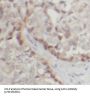 Activated CDC42 Kinase 1 (ACK1) Antibody