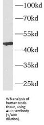 Prostatic Acid Phosphatase (ACPP) Antibody