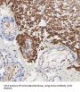ACSL4 / FACL4 Antibody