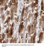 Beta-2 Adrenergic Receptor (ADRB2) Antibody