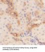 Adrenomedullin (ADM) Antibody
