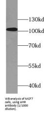 Aryl Hydrocarbon Receptor (AHR) Antibody